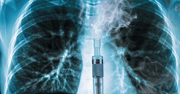 Vaping device inside lung X-ray